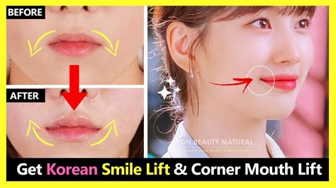 best lip lifters in korea.